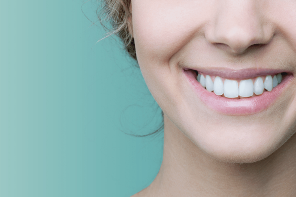 ابتسامة هوليوود 1 ابتسامه هوليوود