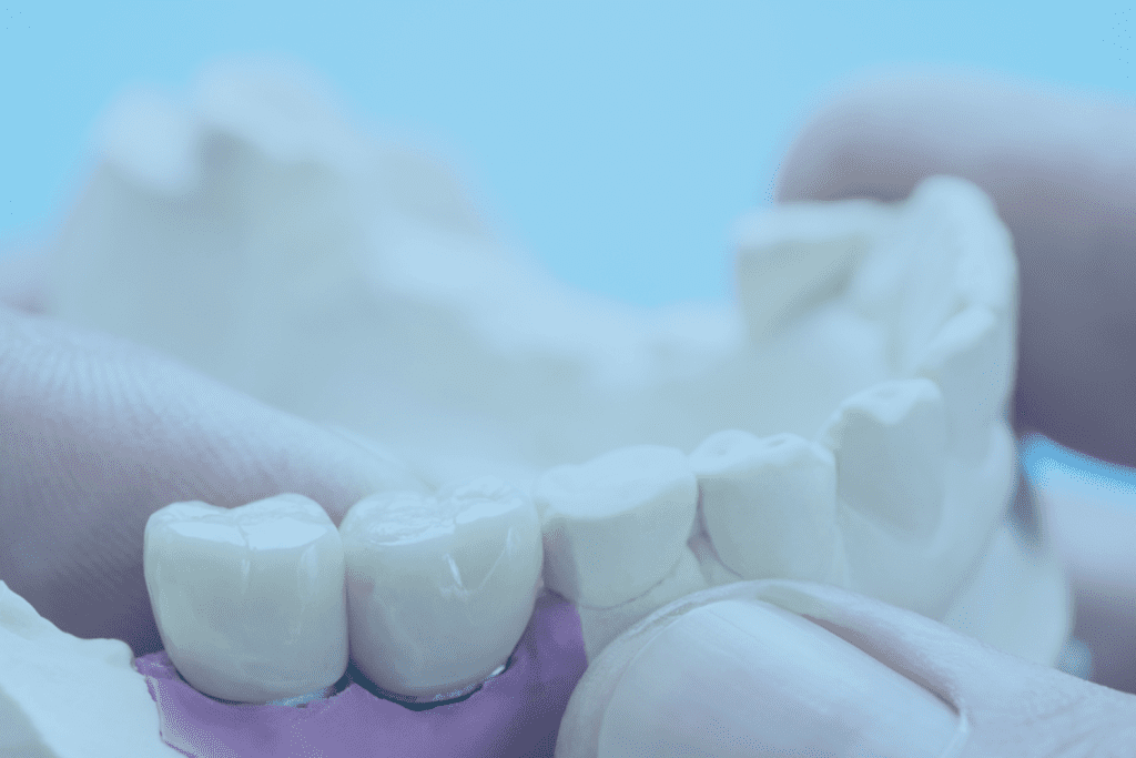 تجميل اللثة