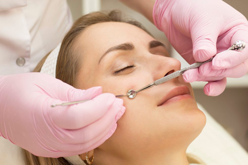 تقشير البشرة السطحي