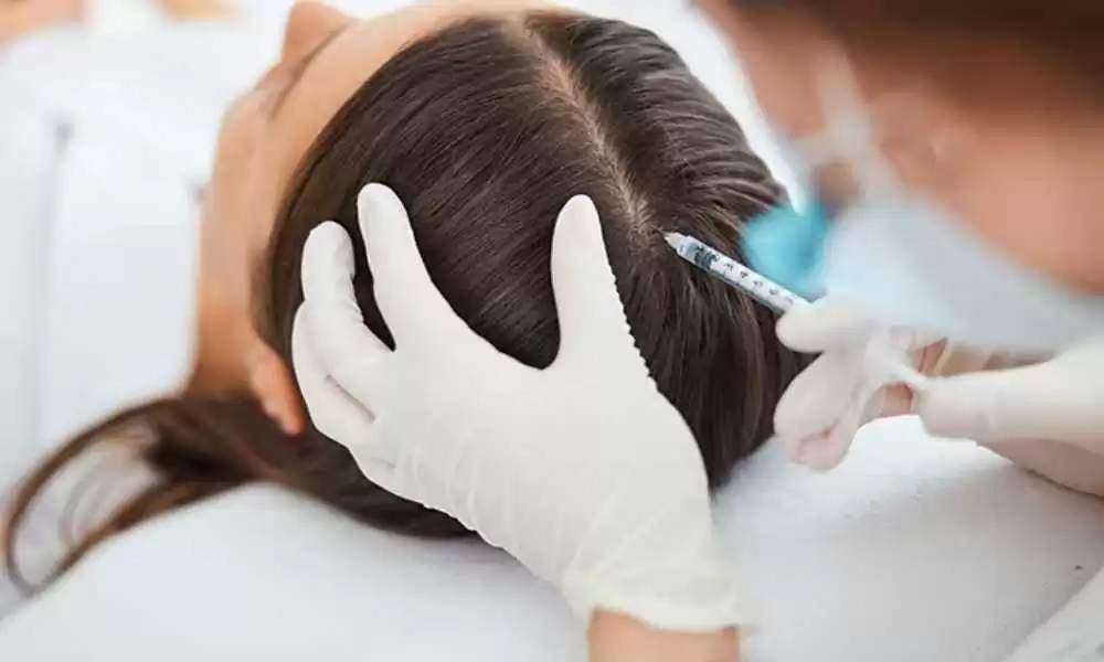 Price of PRP (Platelet-Rich Plasma) injections for hair for men and women 2 سعر ابر البلازما للشعر