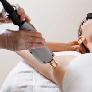 اذا طلع الشعر بعد الليزر كيف اشيله