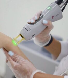 تعليمات بعد الليزر