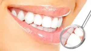 Medical Information 44 الفرق بين هوليود سمايل والفينير