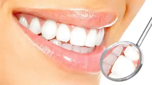 الفرق بين هوليود سمايل والفينير​