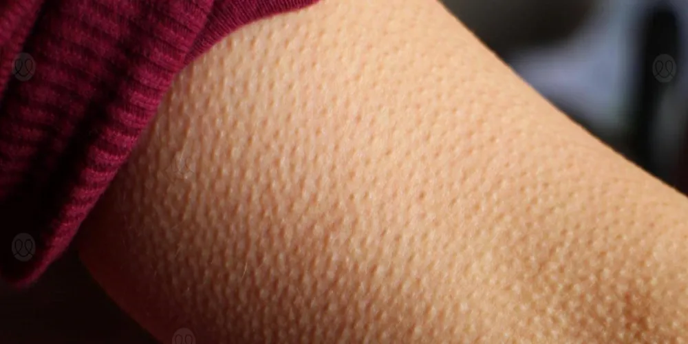 التخلص من جلد الوزة في المناطق الحساسة 2 التخلص من جلد الوزة في المناطق الحساسة