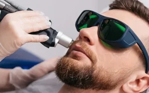 تحديد الذقن بالليزر